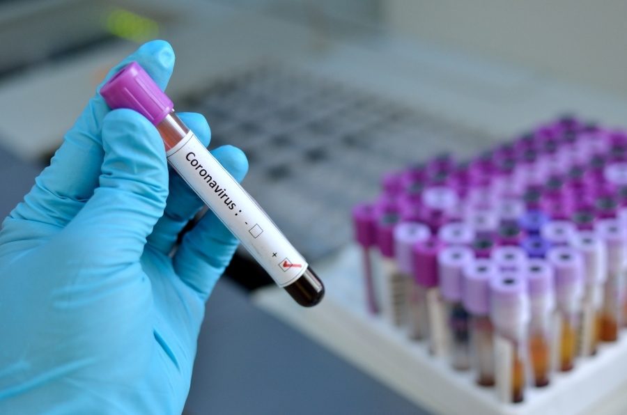 Coronavirus: la decisione del Tribunale di Milano circa le visite genitori-figli